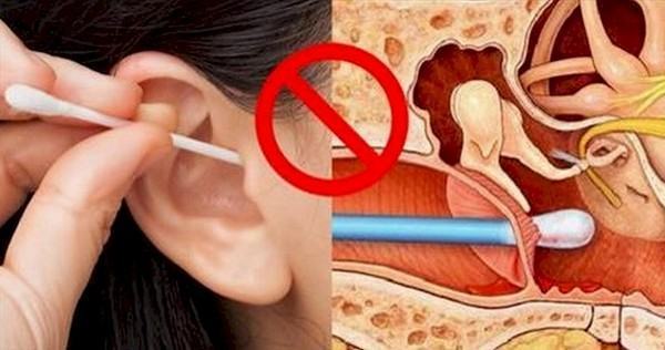 Vệ sinh tai sạch sẽ để tránh ngứa tai